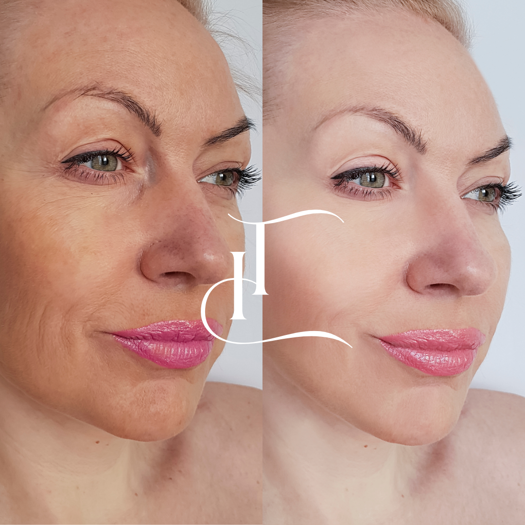 Especialista-em-Harmonizacao-Facial-6-1.png
