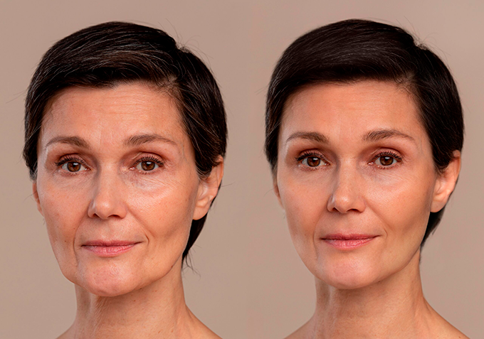 Antes e depois da harmonização: o que muda (e o que permanece)